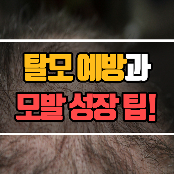  두피 관리 팁 - 탈모 예방과 모발 성장