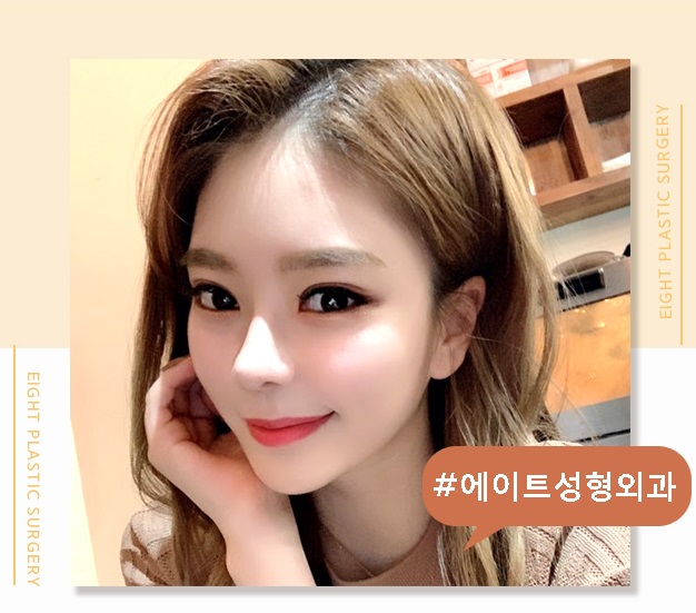  눈매성형 후 마주한 또렷한 눈