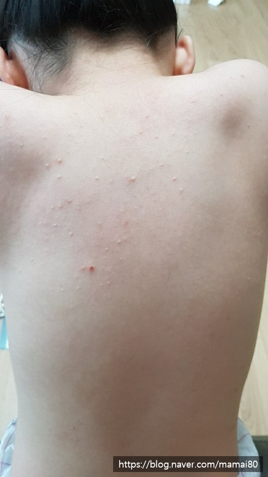 ìì ë¬¼ì¬ë§ê· ë²ì§ë¤ ë¤ì´ë² ë¸ë¡ê·¸