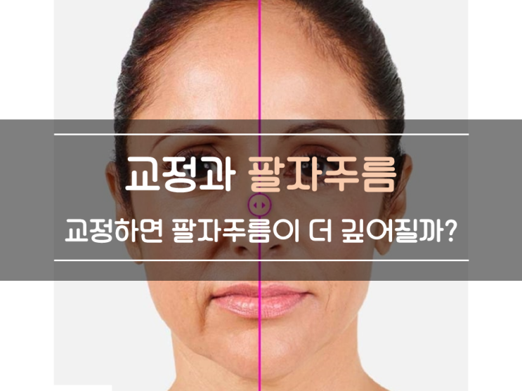 치아교정했더니 팔자주름이 더 깊어졌어요? 교정 부작용인가요? 교정하면 진짜 팔자주름이 생길까?