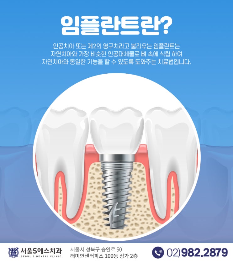 미아역 치과 임플란트 잘하는 치과 알려드려요 미아역 치과 임플란트 잘하는 치과 알려드려요