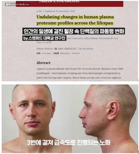 30대 여성 영양제, 꼭 챙겨야 할 것은?