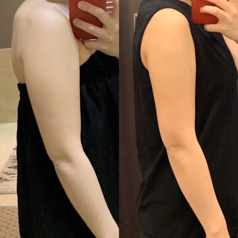 팔 무한람스 약 60일 경과 솔직후기 : 네이버 블로그 팔 무한람스 약 60일 경과 솔직후기 : 네이버 블로그