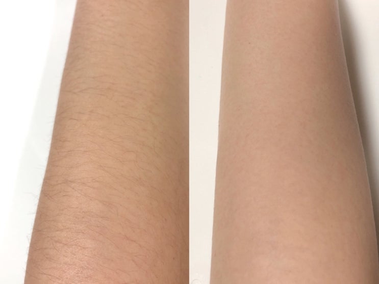  올리브영제모크림으로 셀프왁싱! 바르는 닥터데이즈Dr.days 제모크림