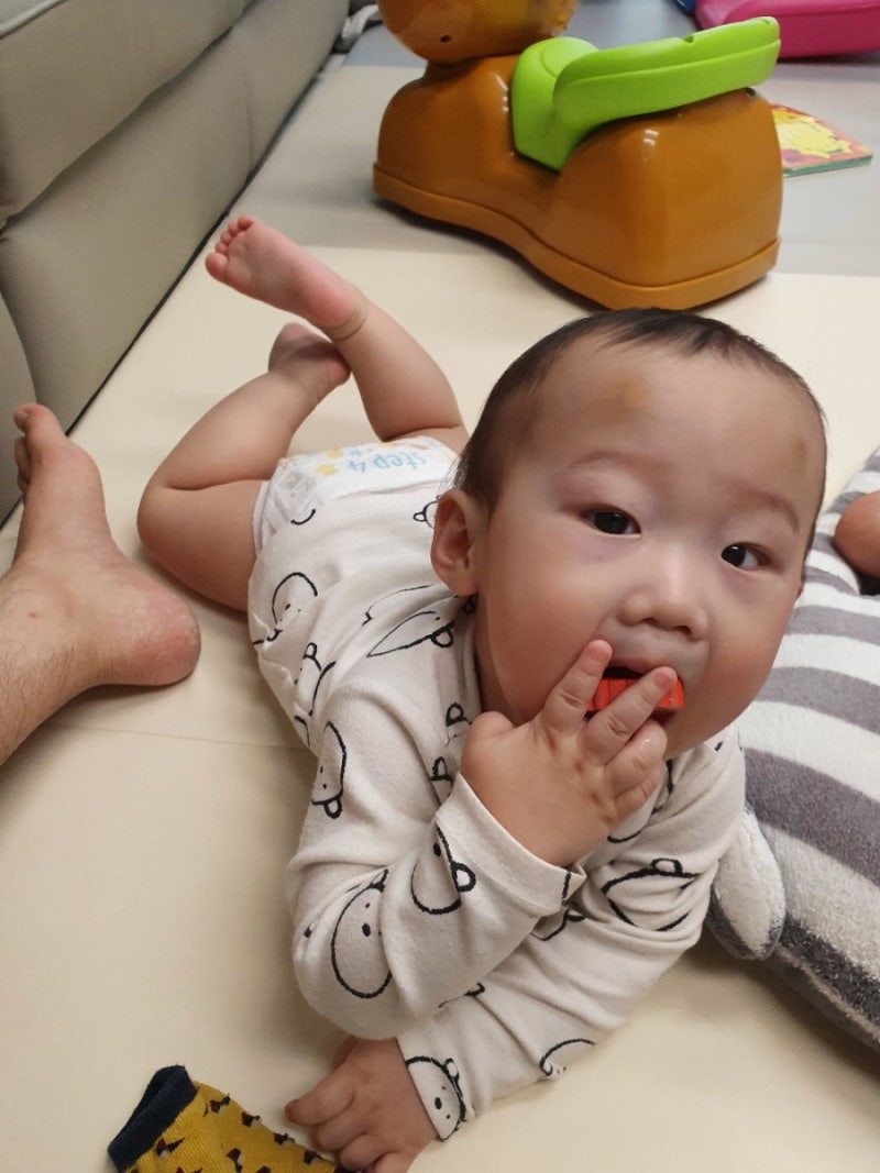 10개월 아기 넘어짐사고(멍크림후기) 7
