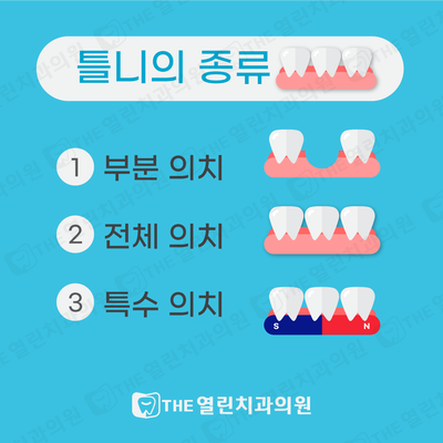  안성치과 안성 THE열린치과 보험틀니2