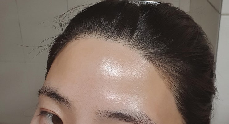 웨촬준비 :D 헤어라인왁싱으로 깔끔하게! 실력좋은 개봉왁싱 ITZZY