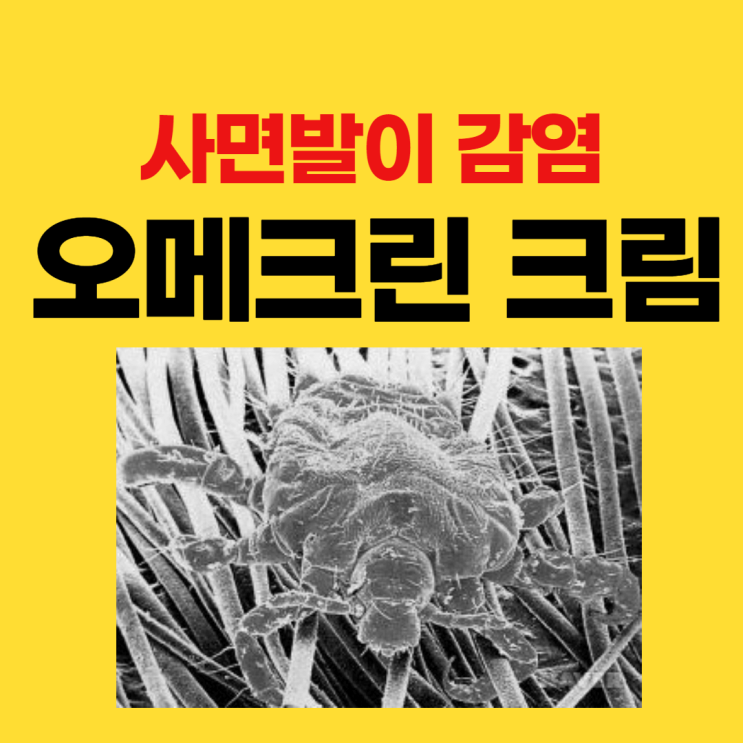 사면발이 증상과 약, 오메크린 크림 사용법