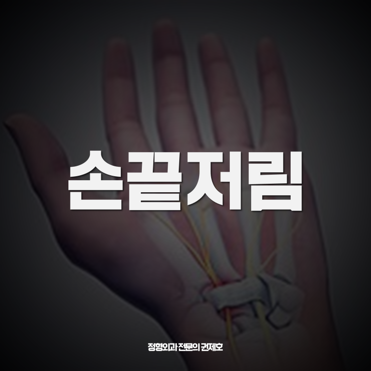  팔꿈치 물혹으로 손가락 저림 palsy