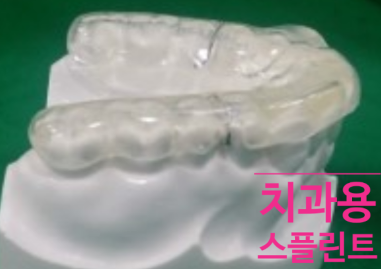  단순히 이갈이 방지를 위해 아무 방법이나 쓰면 안 됩니다!