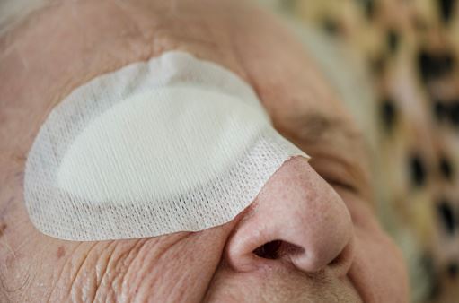 “백내장 수술에 렌즈 공짜” 믿었다가 보험사기 공범되는 노인들