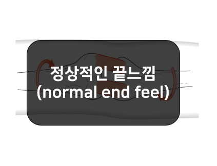 관절가동범위의 정상적인 끝느낌(normal end feel)