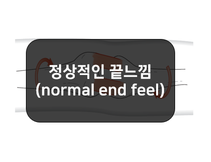  관절가동범위의 정상적인 끝느낌(normal end feel)