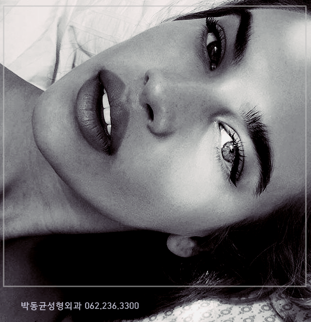  광주눈매교정 하면 눈매가 서글서글해지나요?