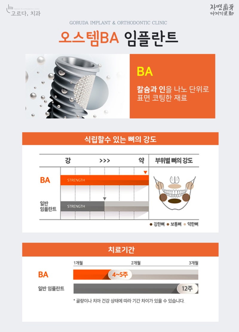 보형물의 종류, 좋은 재료? 4