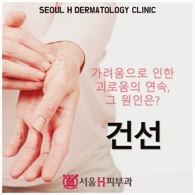  울산가려움증 서울에이치피부과에서 알아보세요