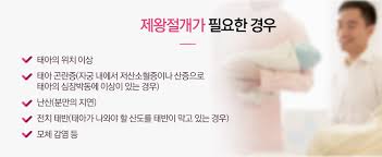  정상분만단계 준비 1편 : 분만초기징후 검진방법 태아건강사정
