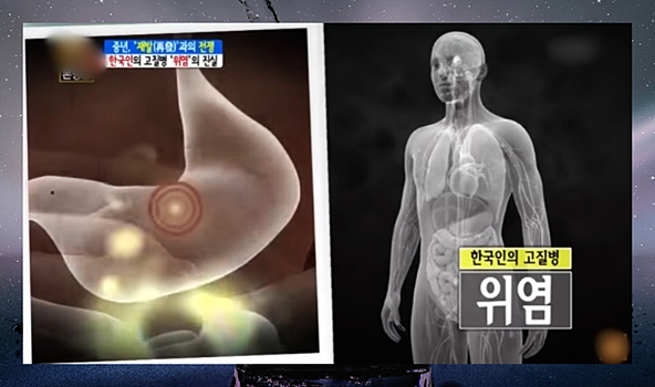 위염에 좋은 차, 성분을 알고 먹으면 더 좋다! 위염에 좋은 차, 성분을 알고 먹으면 더 좋다!