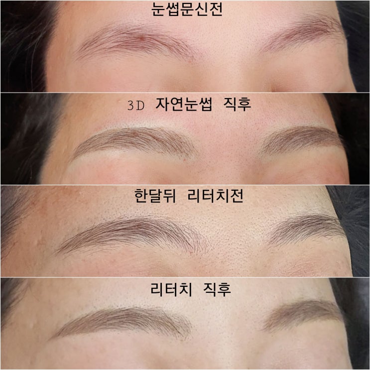  눈썹문신탈각후/눈썹문신탈각/연예인 반영구 눈썹문신 전문샵 비비네
