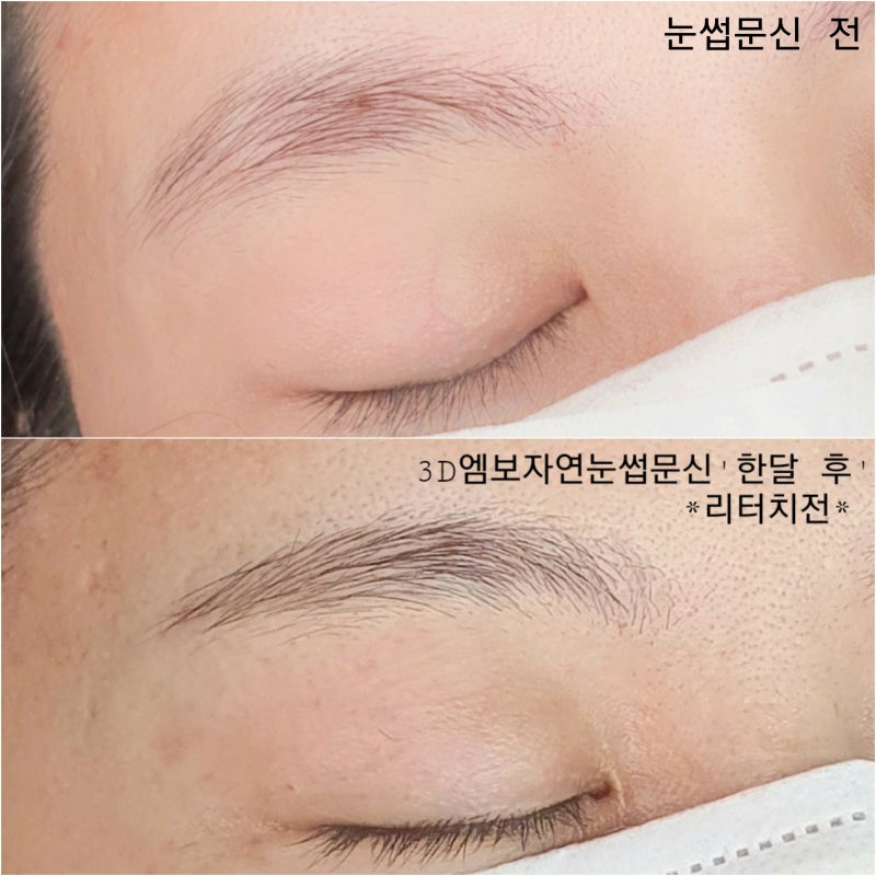 반영구 눈썹, 자연스러운 문신제거, 터치업을 할 수 있는 곳