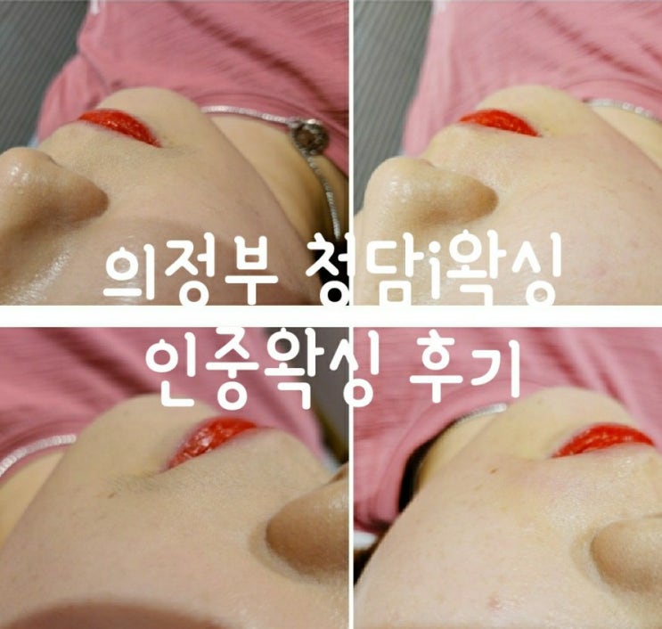  의정부 청담i왁싱 반영구눈썹 머신패더링 리터치+인중왁싱 리얼후기