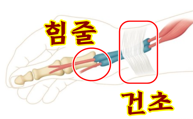  손목 아플때 병원 가기전 핀켈스타인 검사 쉬워요.
