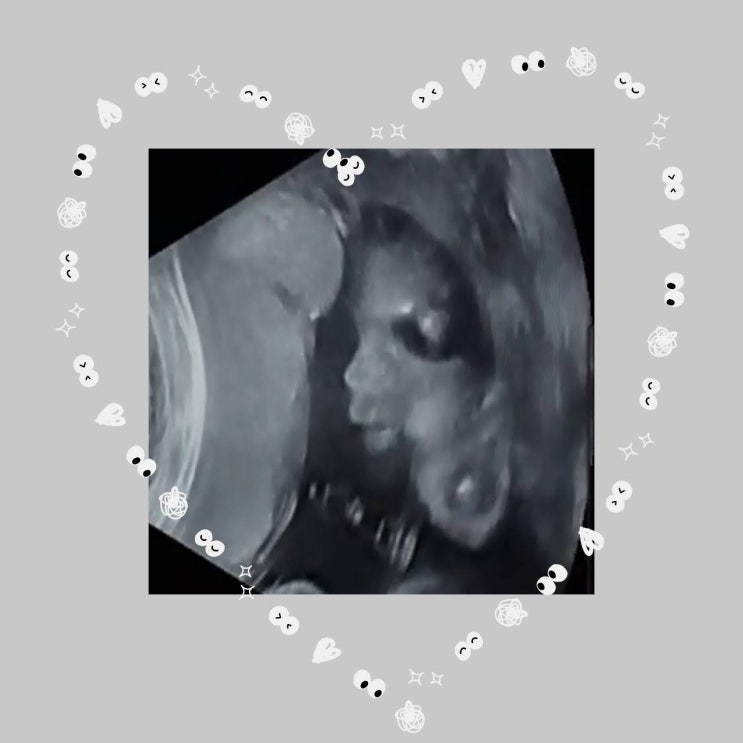 임신7개월증상, 임신24주~임신27주 일상 / 임당검사, 임신부종, 임산부수면자세