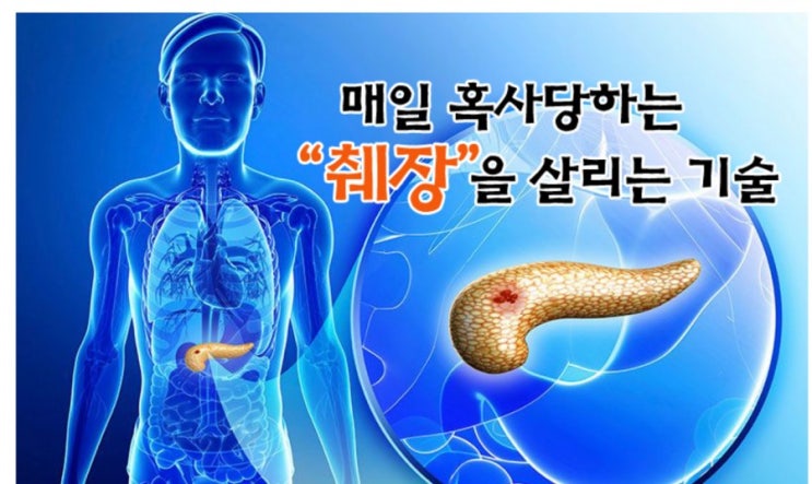  매일 혹사당하는 "췌장"을 살리는 기술