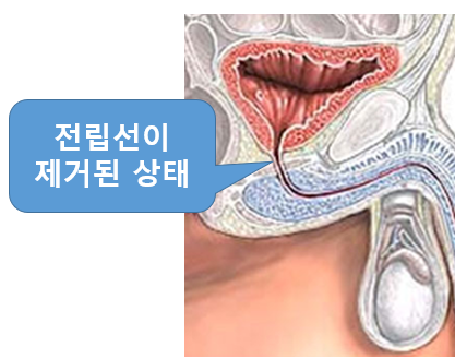 남자 전립선 위치, 기능 : 네이버 블로그 남자 전립선 위치, 기능 : 네이버 블로그