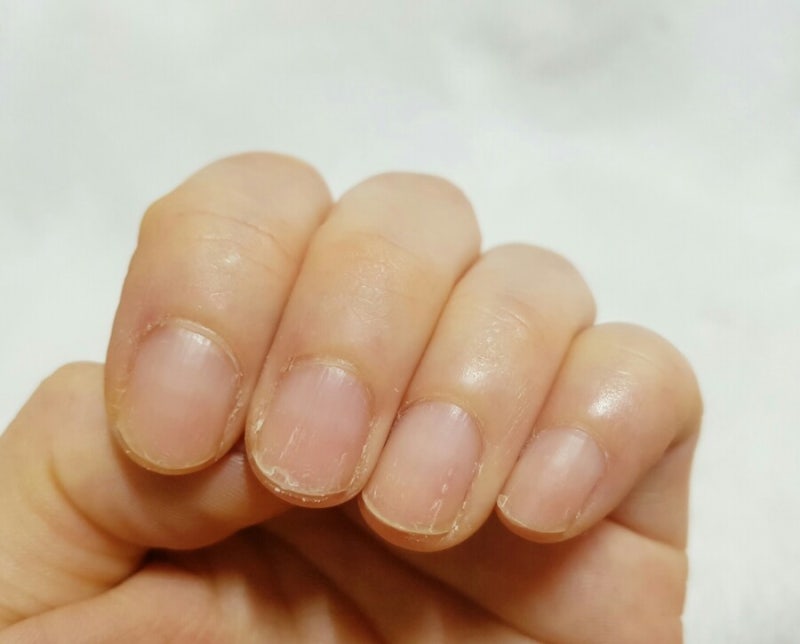 큐티클 오일 손톱 영양제 일상백과 오리올 젤네일을 쉬고 있습니다. 손톱의 울퉁불퉁함이 심해졌거든요.