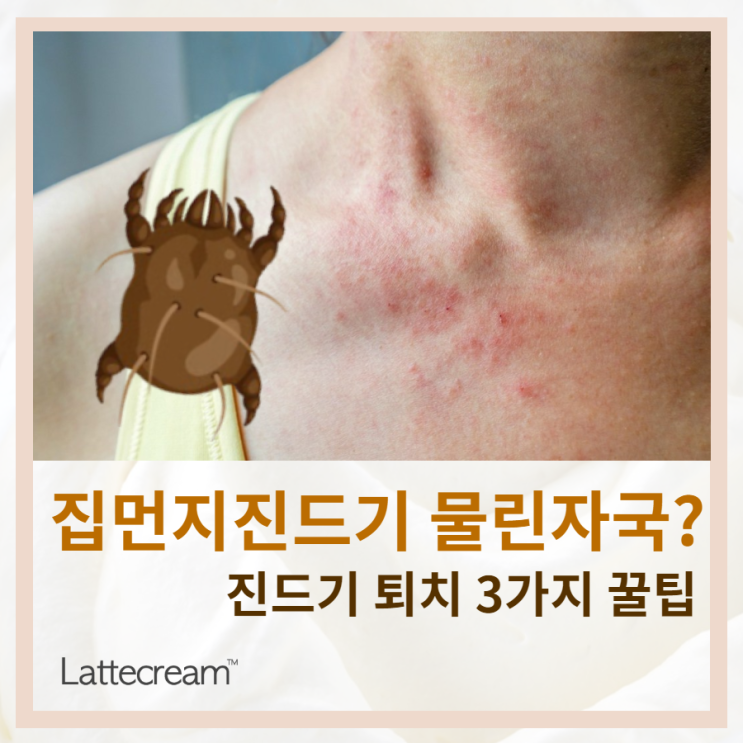 집진드기 물렸을 때 어떻게 해야할까? [집먼지 진드기 퇴치법]