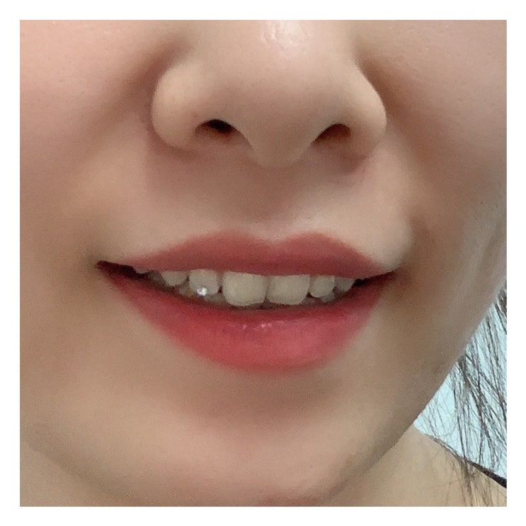  강남 인싸템 투스젬 toothgems 치아보석 리얼 후기