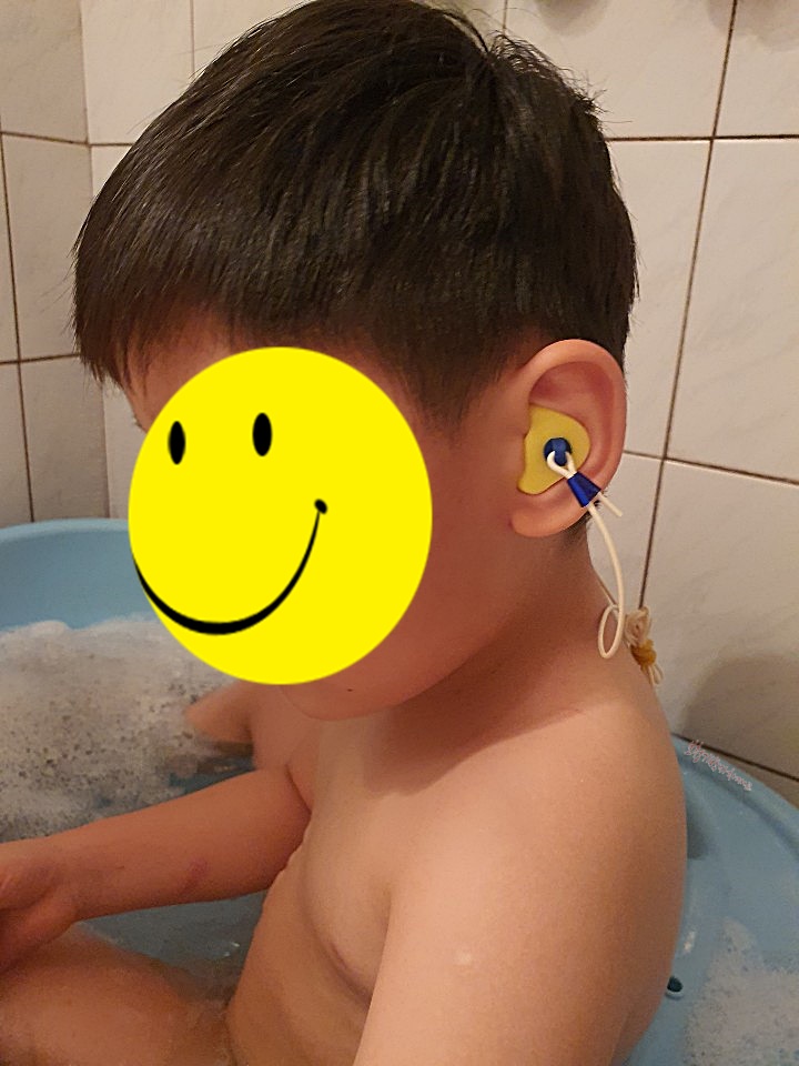 청주보청기 여름철 귀 건강 지키기