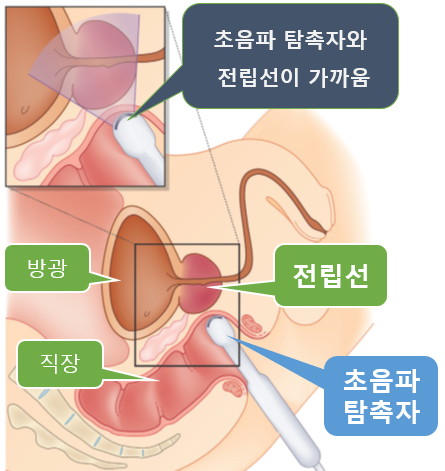 남자 전립선 위치, 기능 : 네이버 블로그 남자 전립선 위치, 기능 : 네이버 블로그