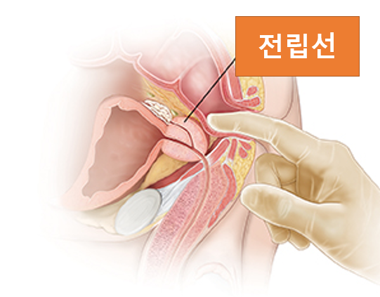 남자 전립선 위치, 기능 : 네이버 블로그 남자 전립선 위치, 기능 : 네이버 블로그