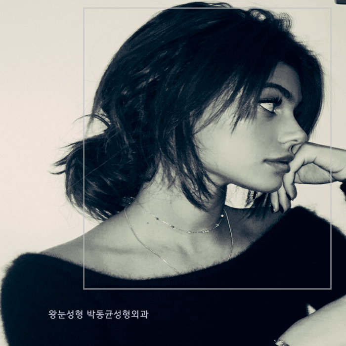  광주코성형 했더니 턱 깎았냐고? 나 참!