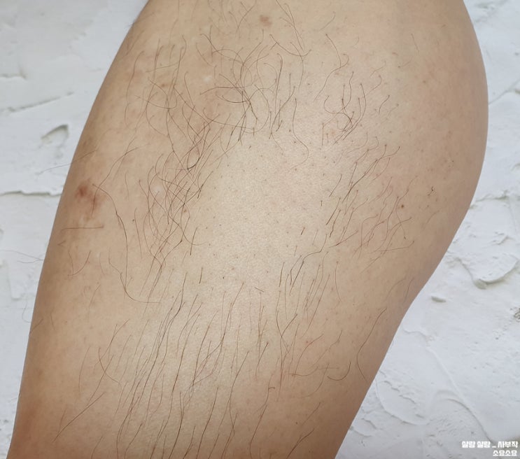  여자, 남자 제모크림_ 통증없이 잡털파티로 올여름 제모 끝!