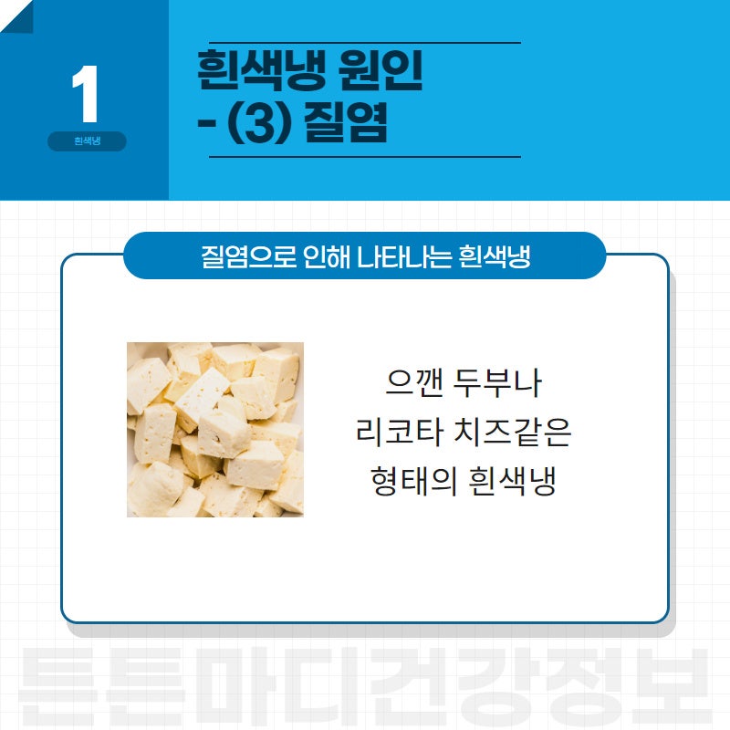 흰색냉 때문에 걱정이라면? 생기는 이유 & 예방법 : 네이버 블로그 흰색냉 때문에 걱정이라면? 생기는 이유 & 예방법 : 네이버 블로그