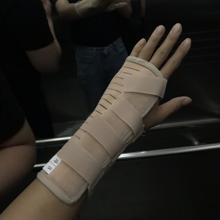  손목바사삭:( 손목 삼각근 손상 인대 찢어짐