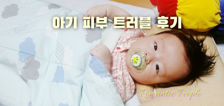 아기 피부트러블 개선후기 아기 피부트러블 개선후기