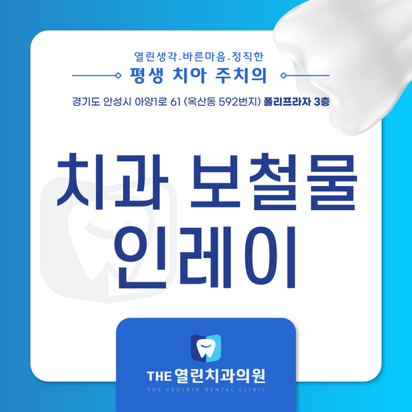 안성보철치료, 보철물 종류 어떤 것이 있나요? 보철물의 종류1편 인레이