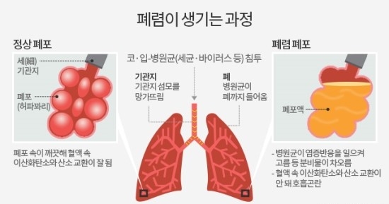  [간호학과 컨퍼런스, 케이스스터디 팁]컨퍼런스, 케이스스터디, 간호과정 세우는 법, 잘하는 방법
