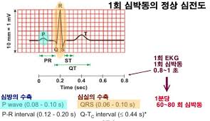 EKG심전도 기본파형 사지유도 5편 : 심방부정맥 조기수축 발작성 심방세동