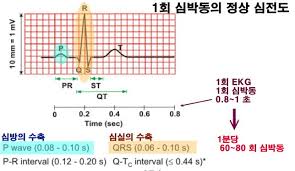  EKG심전도 기본파형 사지유도 5편 : 심방부정맥 조기수축 발작성 심방세동