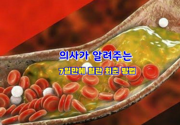 의사가 알려주는 7일만에 혈관 회춘 방법