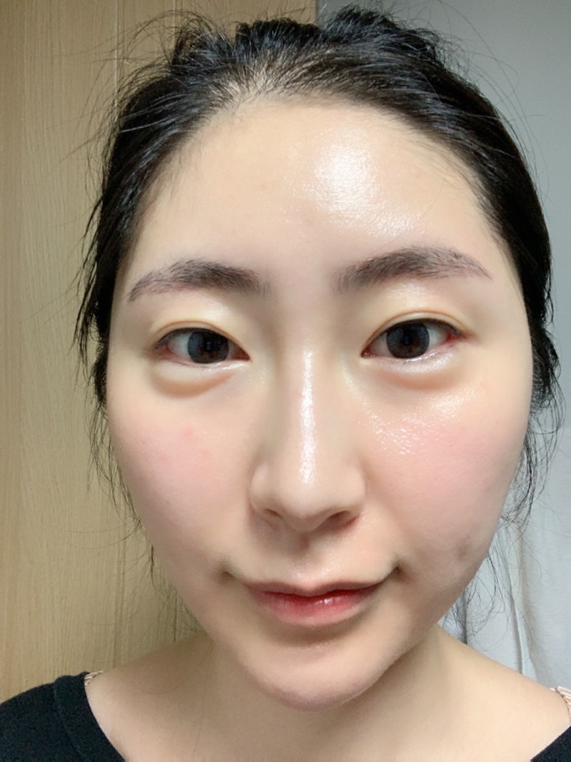 [BEAUTY] 청담 피부과 여자