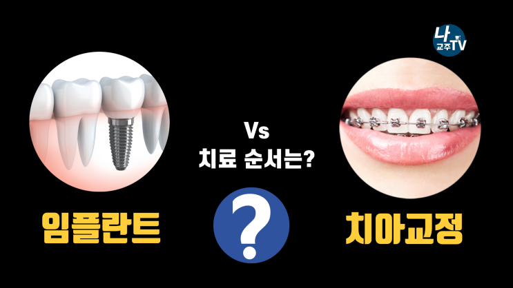 헷갈리기 쉬운 충치치료, 교정치료, 임플란트, 크라운 치료 순서 정리