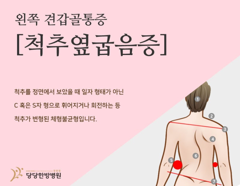 왼쪽 견갑골 아래 통증 장기간 반복 발생