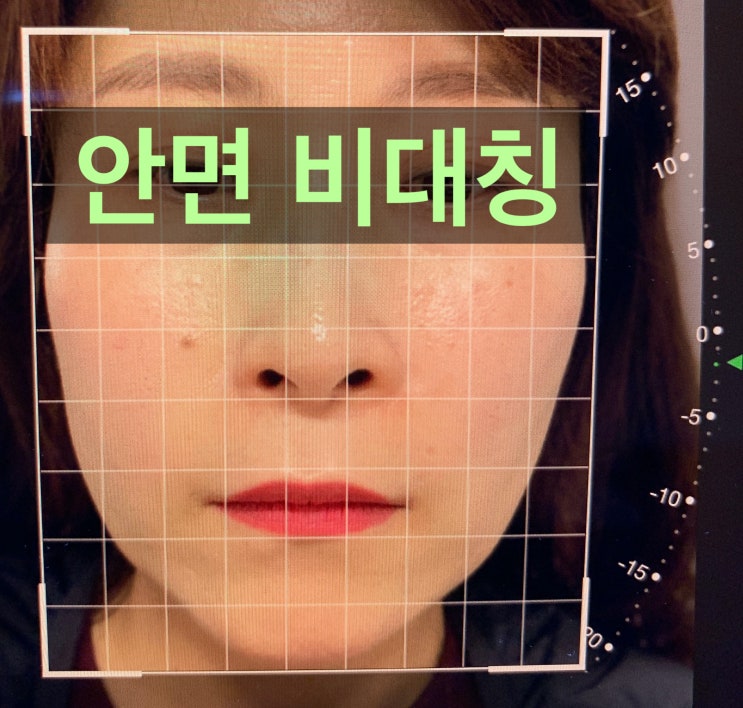  대전자세교정 호흡으로 안면비대칭 교정한다