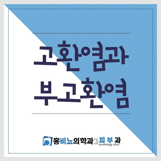 고환염과 부고환염